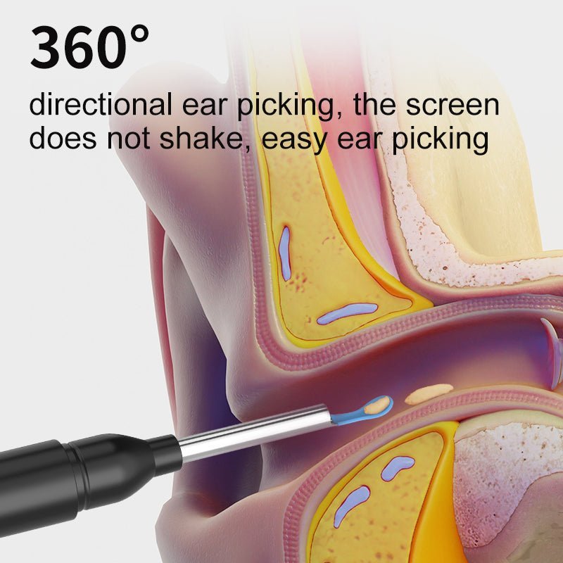 AURIVIEW – Smart Ear Cleaner with HD Camera 4