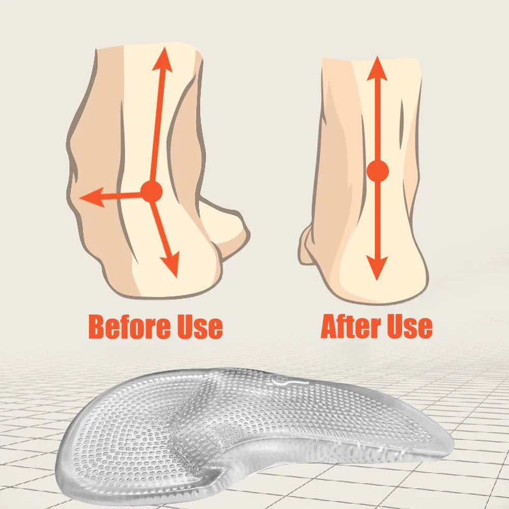 GELSTRIDE – Silicone Gel Orthopedic Insoles for All-Day Comfort 5
