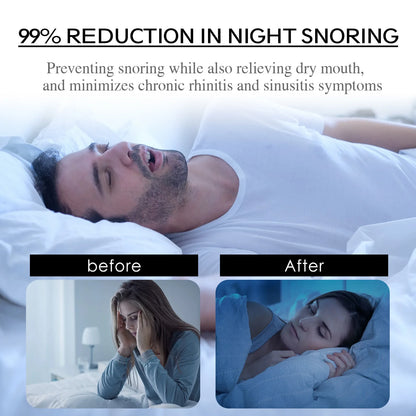 Anti Snoring Mouth Tape for Sleep - Comfortable Tape to Promote Nose Breathing 2