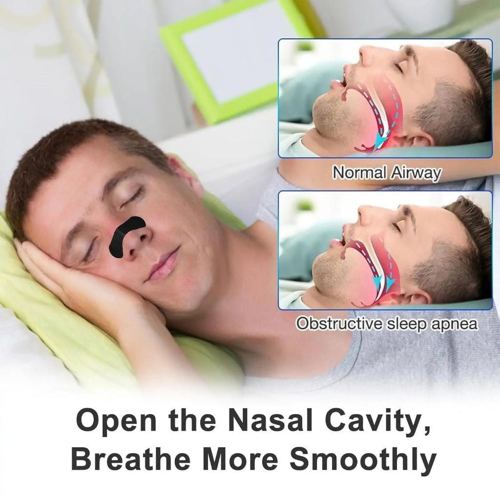 BreathEasy Nasal Breathing Strips - Enhanced Airflow for Sleep & Exercise 1
