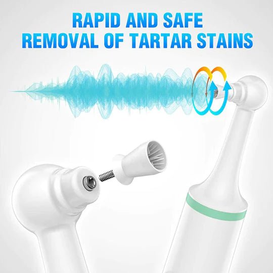 SmilePro Sonic Dental Cleaner | Removes Plaque & Tartar | Ultrasonic Tooth Cleaning Tool | Home Oral Care Device 8