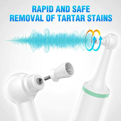 SmilePro Sonic Dental Cleaner | Removes Plaque & Tartar | Ultrasonic Tooth Cleaning Tool | Home Oral Care Device 8